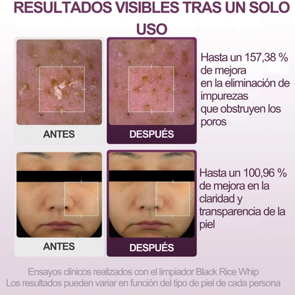 Limpiador Facial de Arroz: Limpieza Profunda y Poros Libres